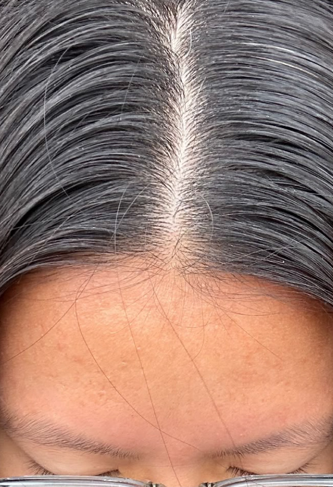 Ms. Koh, before