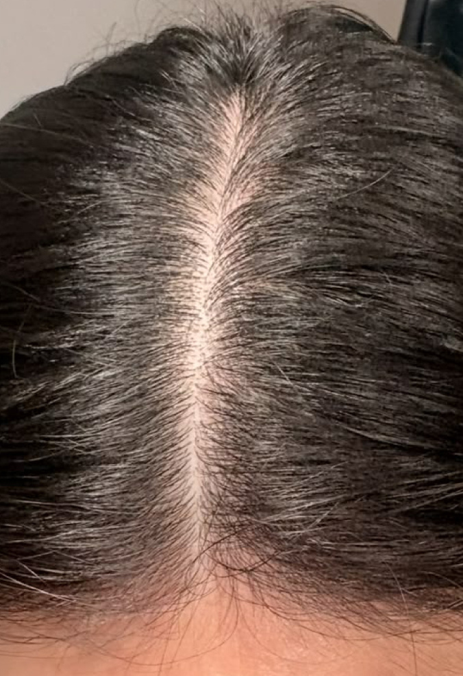 Ms. Susanty, before
